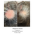 Calecim Advanced Hair System Kit